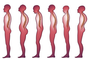 Posture: What, Why, and How? – EVERYDAY POSTURE